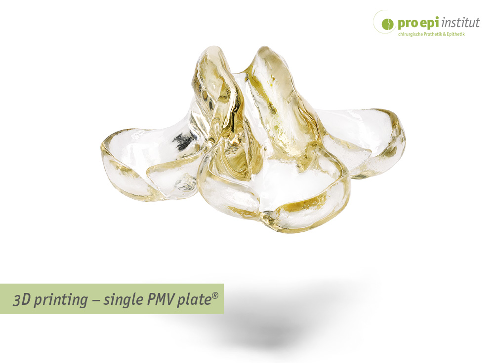 3D printing – single PMV plate®