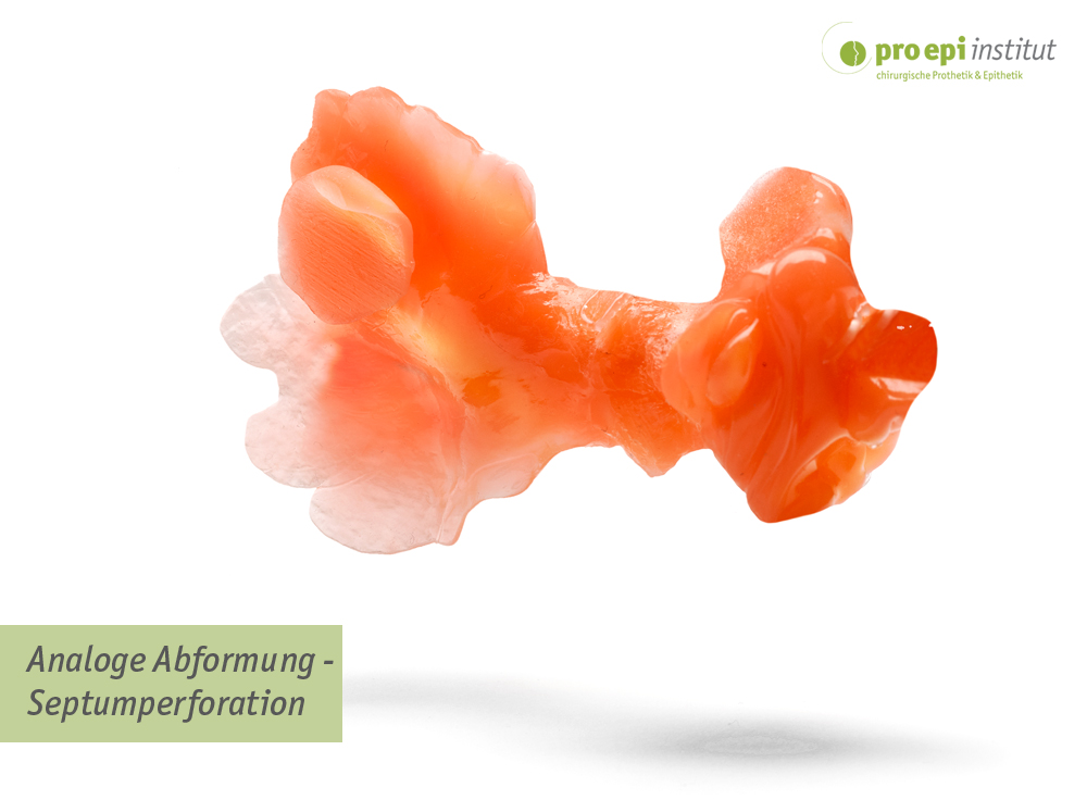 Analoge Abformung - Septumperforation